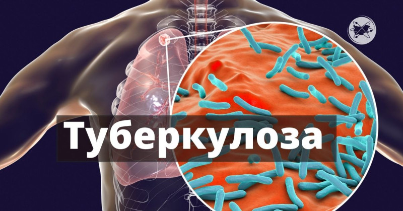 Снимка на новина 13757